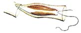 Dinobryon