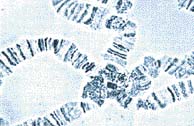 Obří chromozomy octomilky, viditelné i obyčejným mikroskopem, pomohly odhalit úlohu DNA v dědičnosti
