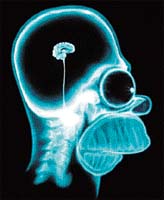 Rentgenový snímek mozku Homera Simpsona