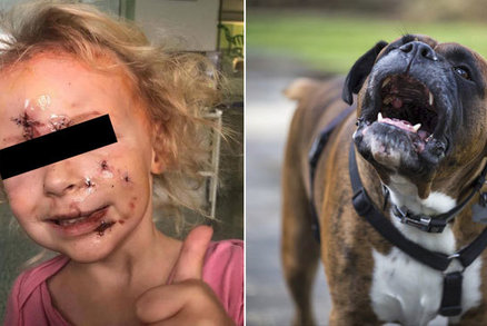 Holčičku (3) brutálně pokousal pes: Rodina poslala dojemný vzkaz záchranářům