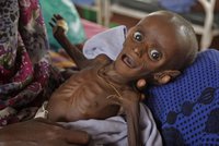 Kvůli suchu děti umírají hlady. Za měsíc jich v Etiopii zemřelo 70