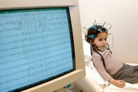Lékaři se snaží vyzrát na epilepsii. V boji jim pomáhají i mobilní aplikace
