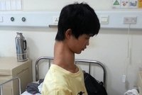 Žirafí kluk z Číny: Vypadá, jak kdyby ho někdo natáhl na skřipci