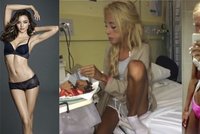 Hubená modelka Miranda Kerr mě dohnala na pokraj smrti: Vážila jsem 31 kilo!