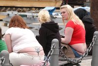 Poprvé v dějinách lidstva: Na světě je víc obézních než podvyživených lidí