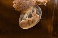 Češky mají problém s těhotenstvím: Stoupá počet samovolných potratů