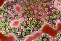 HPV virus: plíživý zabiják, o kterém se málo ví