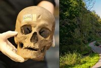 Hrozivý nález v pražské Šárce: V parku ležela lidská lebka