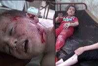 Uplakané a zakrvácené děti, to je výsledek náletů Ruska v Sýrii. Nezabily jediného teroristu