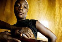 Brutální africký rituál místo antikoncepce: Dívkám žehlí prsa