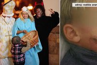 Čert napadl děti v Šumperku leptavou mastí: Útočníkům nebylo ani 15 let