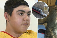 Dětskému kuřákovi e-cigareta vážně popálila nohu: Vybuchla mu v kapse