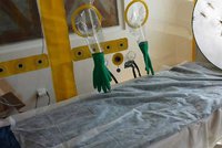V Česku je čtvrtý případ viru zika. Žena se vrátila nakažená z Martiniku