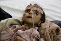 Srdceryvný snímek: Pětiměsíční chlapeček vyhladověl k smrti, jídlo mu vzala válka