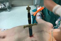 Neuvěřitelné video: Chirurgové vytáhli meč z hrudi muže a zachránili mu tak život