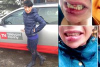 Reportérka Divišová obětí domácího násilí: Začalo to fackou, skončilo vyraženými zuby