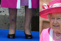 Alžběta II. ukázala bolestivý »doplněk«: Na holeni se královně modrala obrovská modřina