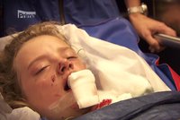 Zuzana (12) z Nemocnice Motol: Kůň jí rozkopl čelist a zuby!