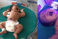 V Indii se narodil pořádný cvalík: Žena přivedla na svět sedmikilové dítě!