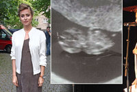 Bývalá moderátorka Novy Emma Smetana maskuje těhotenství: Marně! Prozradila se v občerstvení!
