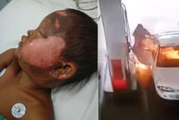 Děsivé video: Chlapec na benzince škrtl zapalovačem a málem uhořel