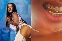 Barbadoská kráska Rihanna v Praze: Náhlý převoz k lékaři!