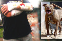Pes v Karviné rozsápal páníčkovi ruce: Napadl i strážníky, museli ho zastřelit