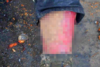 Další extrémně zanedbaný bezdomovec v Plzni: Noha se mu hemžila červy