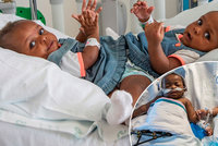 Lékaři oddělili siamská dvojčata srostlá pánví: Obě holčičky přežily