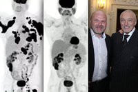 Naděje pro nemocné jako Karel Gott: Takhle rakovina zmizí za 3 měsíce