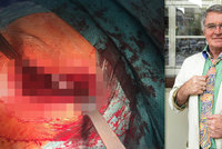 Harapes po výměně kyčle: Drsné foto z operačního stolu!