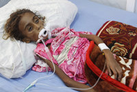 Srdceryvné foto: Holčička (†7) vyhladověla k smrti, jídlo neměla kvůli válce