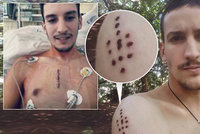 Šamani z Petra (23) vyhání rakovinu vypalováním kůže a jedem: Západní medicína ho zradila