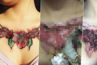 Varování! Dívka šetřila na odstranění tetování. Teď je do smrti znetvořená