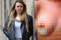 Dívka (24) chtěla krásnější prsa: Po zpackané plastice přišla o bradavky