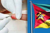 Obřízkou proti AIDS: v Mosambiku ji na radu OSN podstoupí přes 100 000 mužů