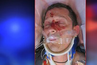 Na Nymbursku srazil zfetovaný řidič cyklistu: Zraněného muže nikdo nezná, policie prosí o pomoc