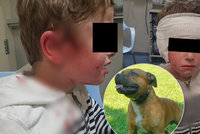 Pes se zakousl chlapci do hlavy (5): Ze sevření čelistí ho vysvobodila jeho máma s tetou
