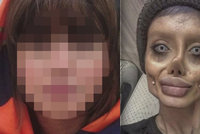 Žena, která vypadá jako mrtvola Angeliny Jolie, odhalila svou pravou tvář: To by nikdo nečekal