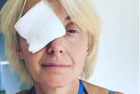 Veronika Žilková po chirurgickém zákroku: Vidí jen na jedno oko!