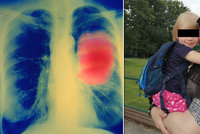 Milan onemocněl rakovinou plic: Protrpěl rok, než dostal správnou léčbu