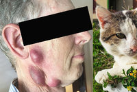 Muži se udělaly na obličeji obří vředy: Infekce od kočky!