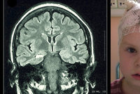 Míša (4) z Ukrajiny má těžkou epilepsii: Operaci mozku musí podstoupit v Praze