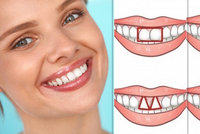 Každý chrup, jiný zub! Jaké povahové vlastnosti prozradí ty vaše?