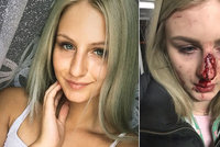 Edina (20) zveřejnila fotografie po útoku expřítele! V krvi skončili další 3 lidé!