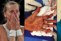 Kauza napadení Kvitové: Žondra tenistku napadl a pořezal jí ruku, dostal osm let!