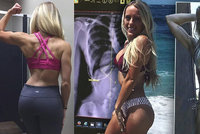 Sexy hvězda Instagramu odmítla operaci páteře: Bez ní může zemřít!
