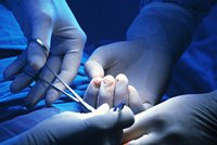 Lékaři při operaci poškodili pacientce (52)  močovod: Podle soudu s tím měla počítat
