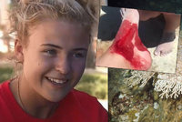 Další útok žraloka: Isabella (15) unikla jen o vlásek, predátor ji kousl do nohy