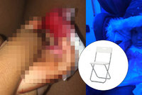 Pozor na rozkládací židli z IKEA: Holčičce málem amputovala prst!